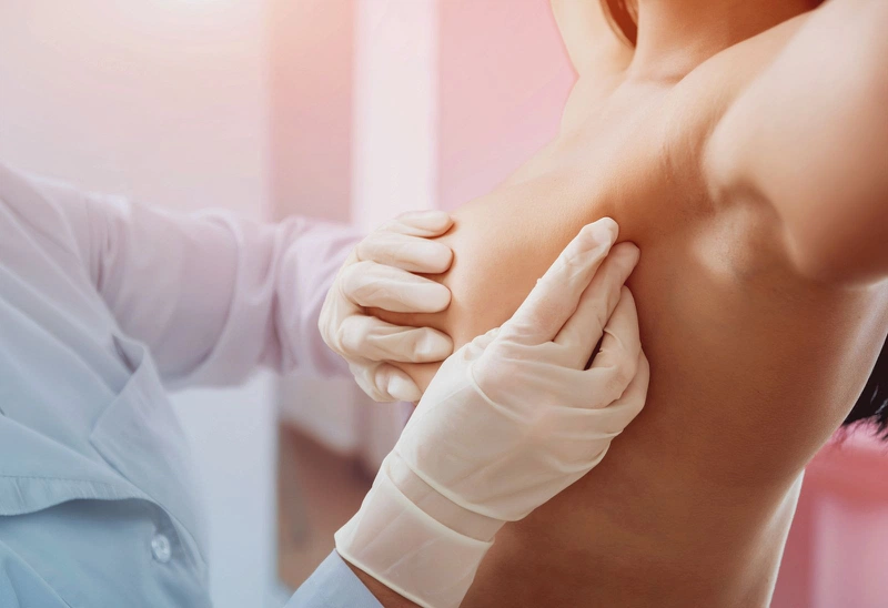 Mối liên hệ giữa ung thư vú và sức khỏe xương 3