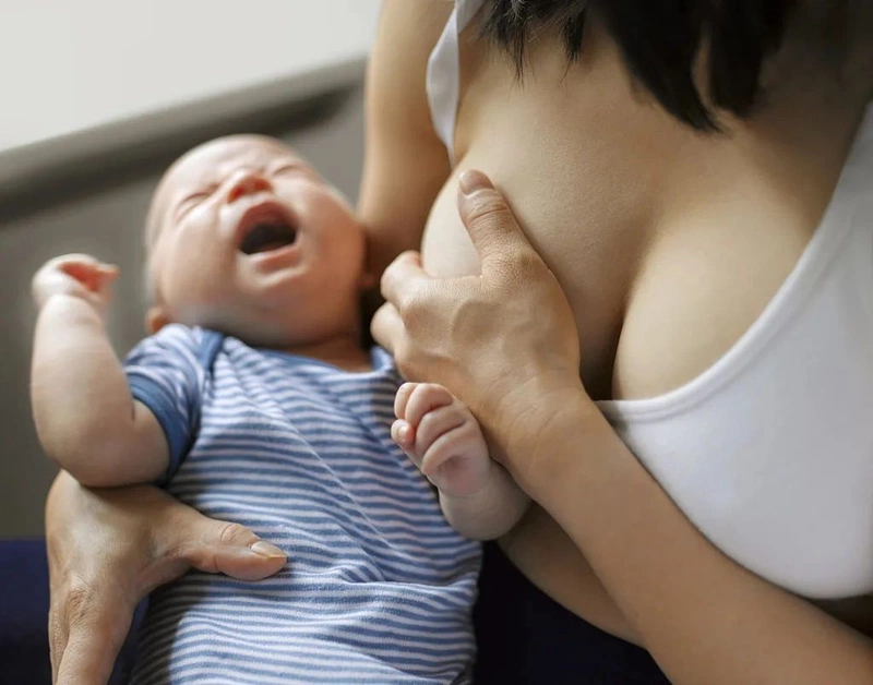 Mẹ bị căng sữa khi cai sữa là điều hay gặp