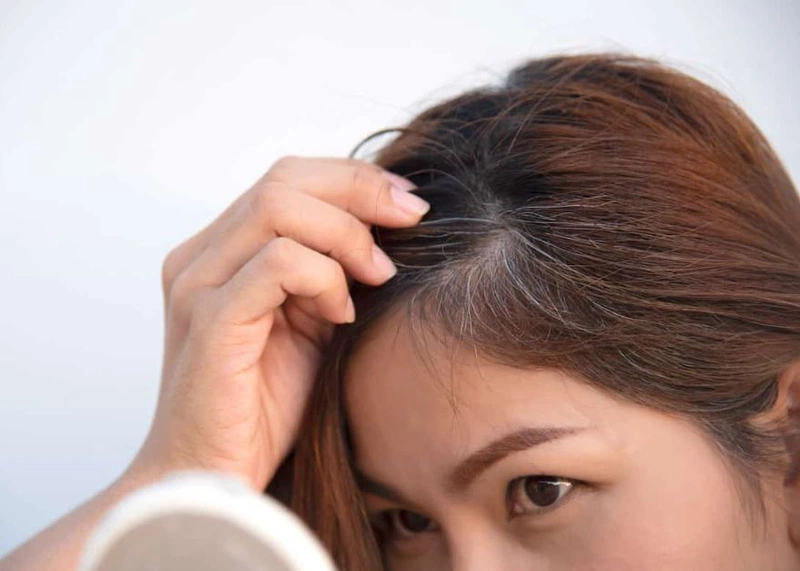 Những nguyên nhân gây tóc bạc sớm