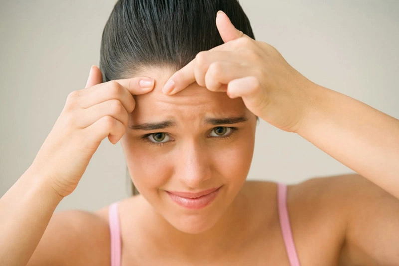 Mụn ẩn trên trán có nguy hiểm không?