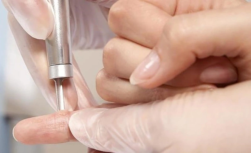 Phân biệt mụn cóc sinh dục và sùi mào gà 4