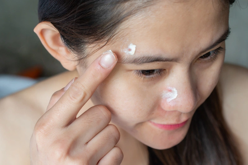 Mụn cứng dưới da: Nguyên nhân và các phương pháp điều trị 3