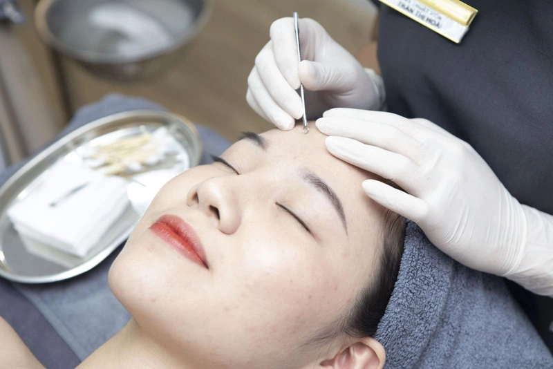 Mụn nhọt không có đầu: Nguyên nhân, triệu chứng và cách phòng ngừa 5
