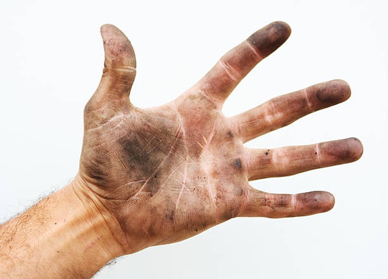 Nặn mủ chín mé có nguy hiểm không? Chữa như thế nào? 1