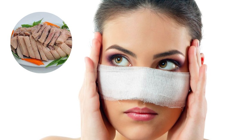 Nâng mũi ăn thịt vịt được không? Cần kiêng thực phẩm gì? 1