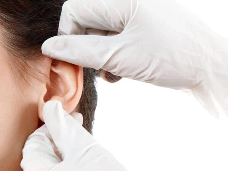 Vị trí lấy sụn tai để nâng mũi