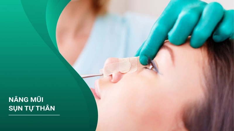 Nâng mũi sụn tự thân giá bao nhiêu?