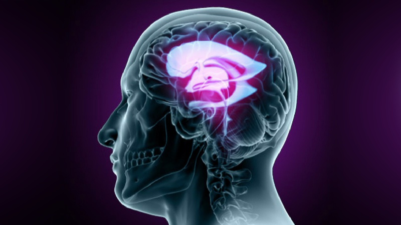 Não úng thủy là bệnh gì? Nguyên nhân và cách điều trị não úng thủy 1