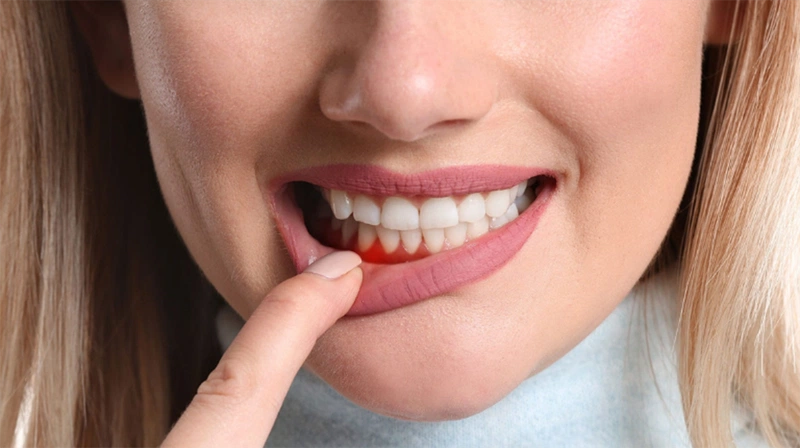 Nên làm gì khi răng bị lão hóa 2