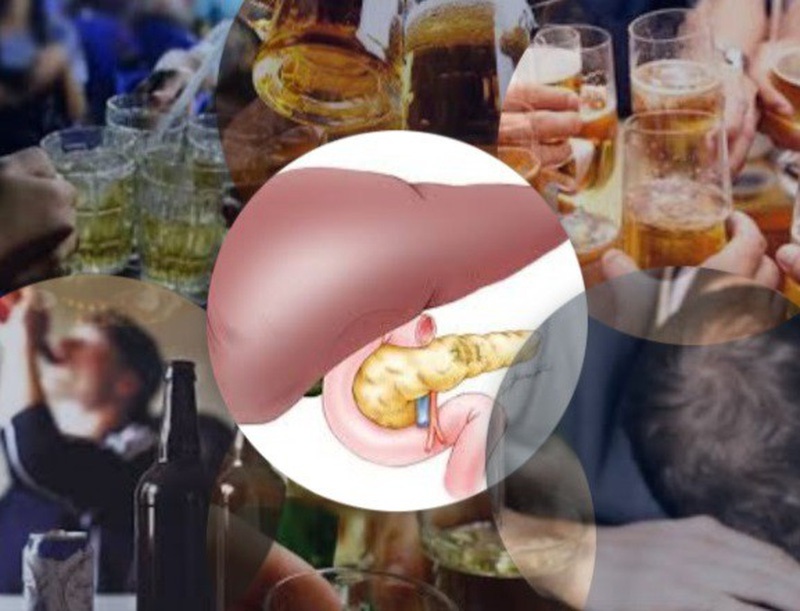 Nghiện rượu: Nguyên nhân của viêm tụy cấp?2