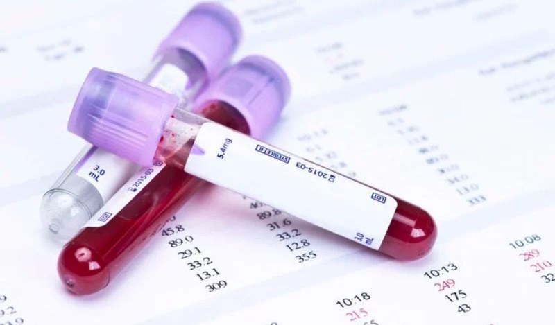 Ngộ độc quinalphos là gì? Chẩn đoán và điều trị như thế nào? 2