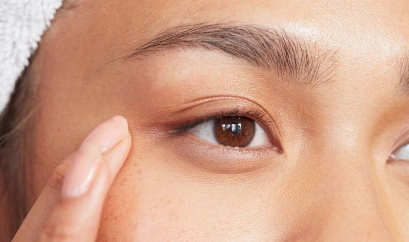 Ngủ mở hé mắt: Nguyên nhân và cách điều trị 2