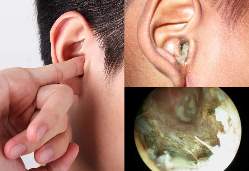 ngứa lỗ tai trái 2