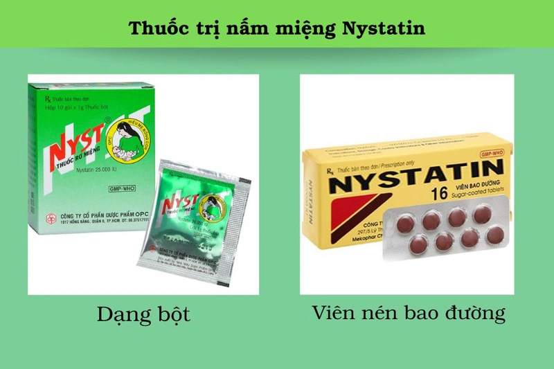 Người bị nấm miệng uống thuốc gì để mau khỏi? 1