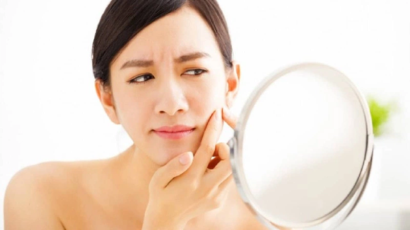 Nguy hiểm khôn lường từ thói quen nặn mụn 2