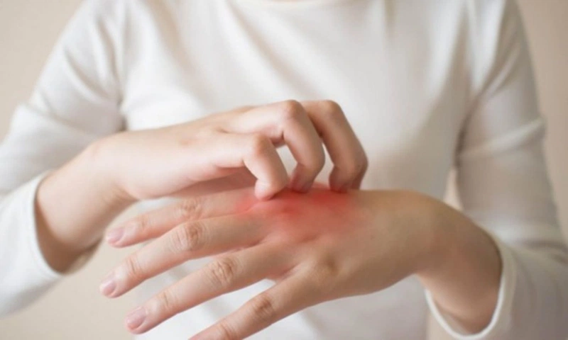 Nguyên nhân bị mụn cóc là do đâu 3