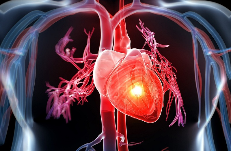 Nguyên nhân xuất hiện cơn đau tim là gì?