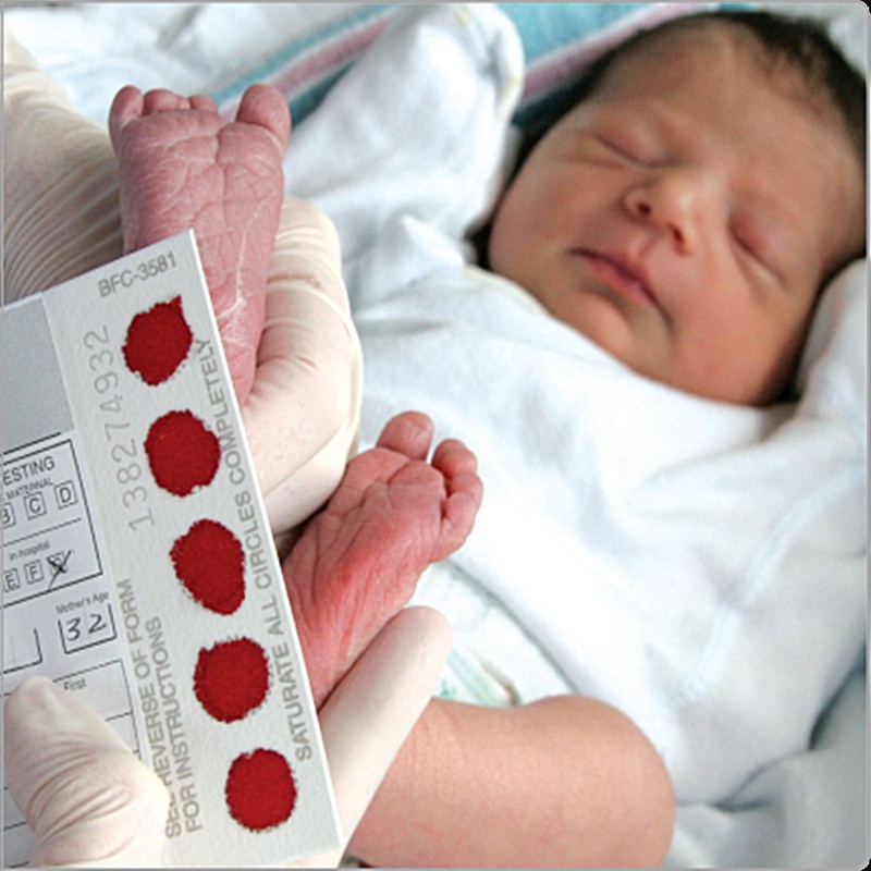 Những đứa trẻ là con có mẹ bị bệnh suy giáp cần được xét nghiệm lấy máu gót chân ngay những ngày đầu chào đời để kiểm tra.