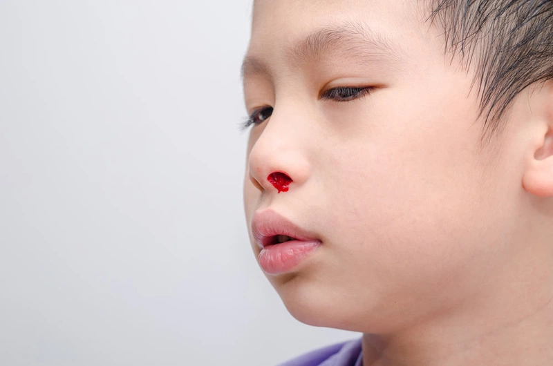 Nguyên nhân gây bệnh rối loạn đông máu ở trẻ sơ sinh 3