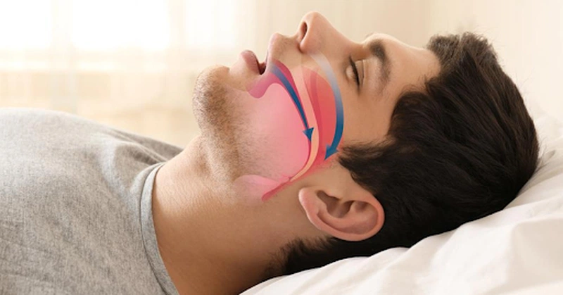 Nguyên nhân gây đái dầm ở người lớn 2