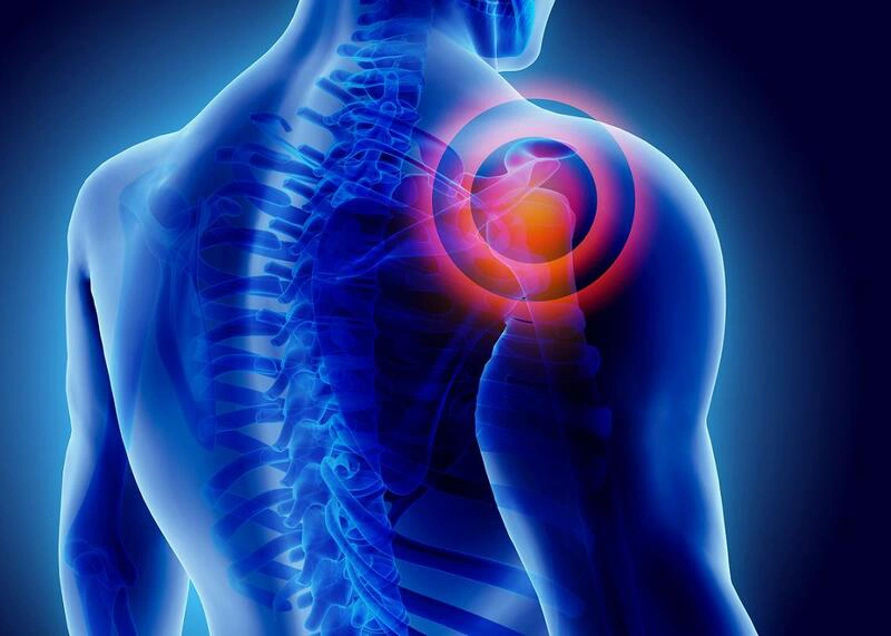 Nguyên nhân gây đau khớp vai sau và cách phòng ngừa 2