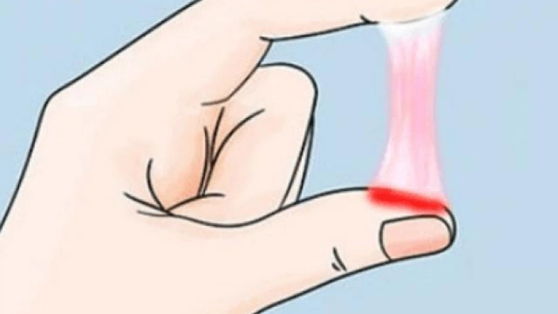 Nguyên nhân gây trễ kinh và ra dịch màu hồng 1