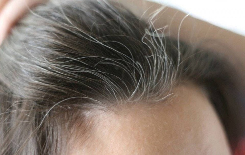 Nguyên nhân khiến tóc bạc sớm và cách chữa trị 2
