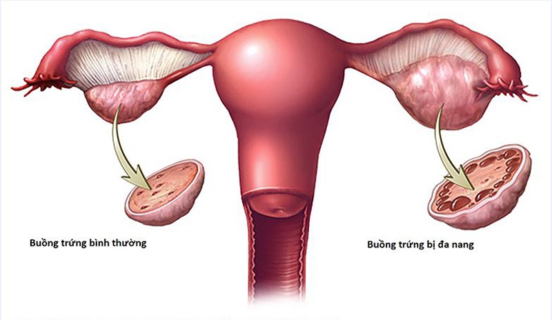 Nguyên nhân mọc lông ở đầu ti và cách cải thiện an toàn 1
