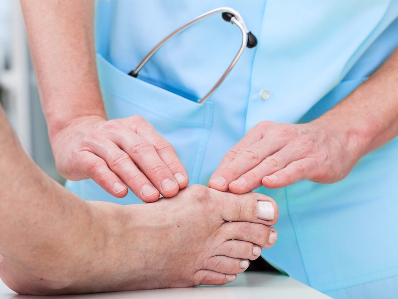 Nguyên nhân nào khiến bệnh gout càng trở nên trầm trọng 2