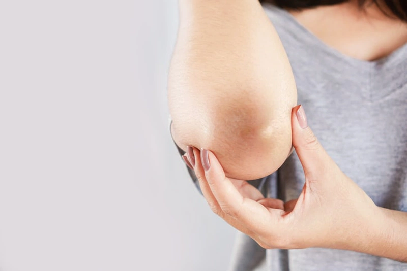 Tập plank bị thâm khuỷu tay có thể do tập sai tư thế