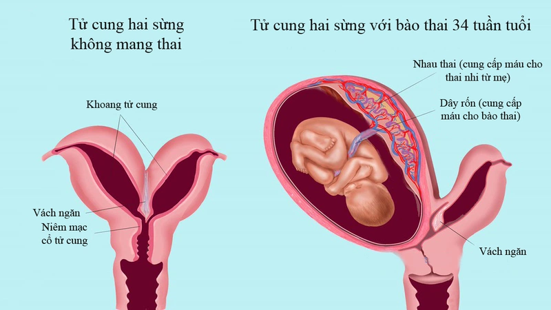 Nguyên nhân tức ngực khó thở khi mang thai tháng cuối và cách giảm triệu chứng 1