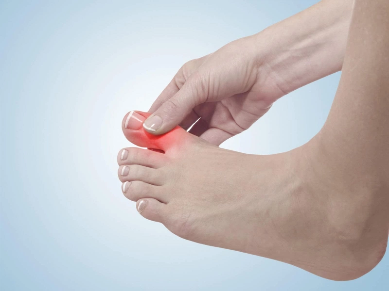 Nguyên nhân và cách khắc phục chạy bộ bị đau ngón chân cái1