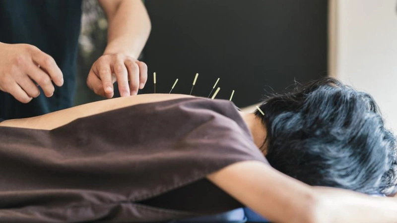 Châm cứu sẽ giúp cân bằng hoạt động thần kinh một cách hiệu quả