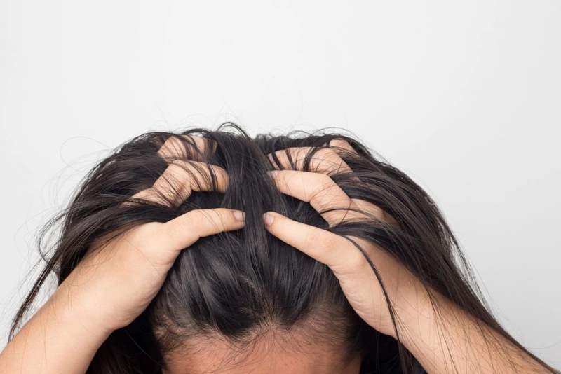 Nguyên nhân gây viêm chân tóc và cách điều trị dứt điểm 1