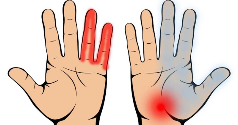 Nhận biết dấu hiệu bệnh tiểu đường thông qua bàn tay cực đơn giản