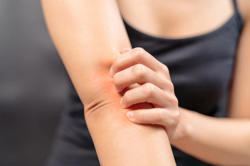 Nhận diện 4 dấu hiệu bị giun đũa chó? Cách điều trị thế nào? 2