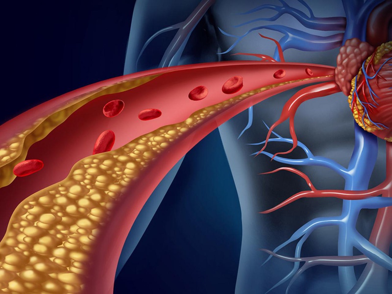 Nhân sâm có thể làm giảm nồng độ cholesterol trong máu