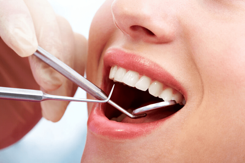 Răng thừa có nên không - Bạn đã biết chưa? 3