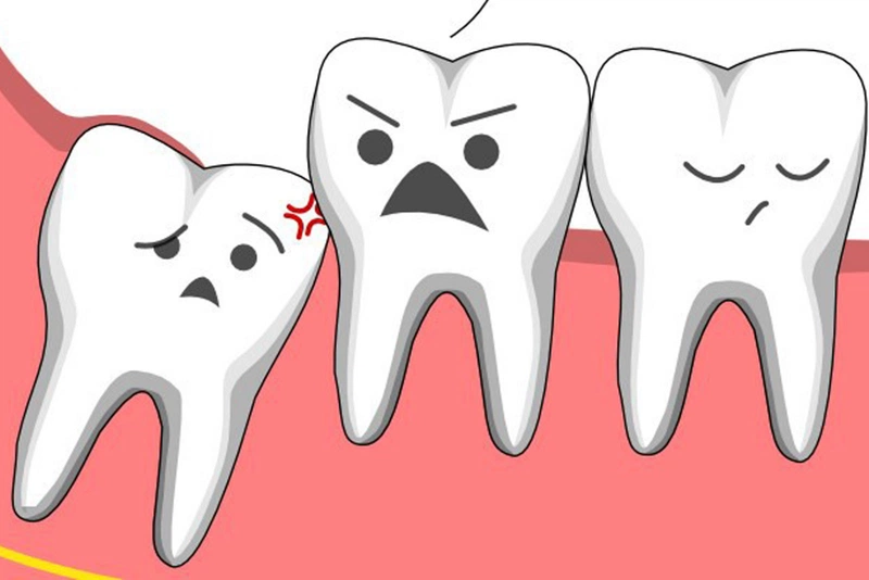 Nhổ răng xong có được súc miệng nước muối không