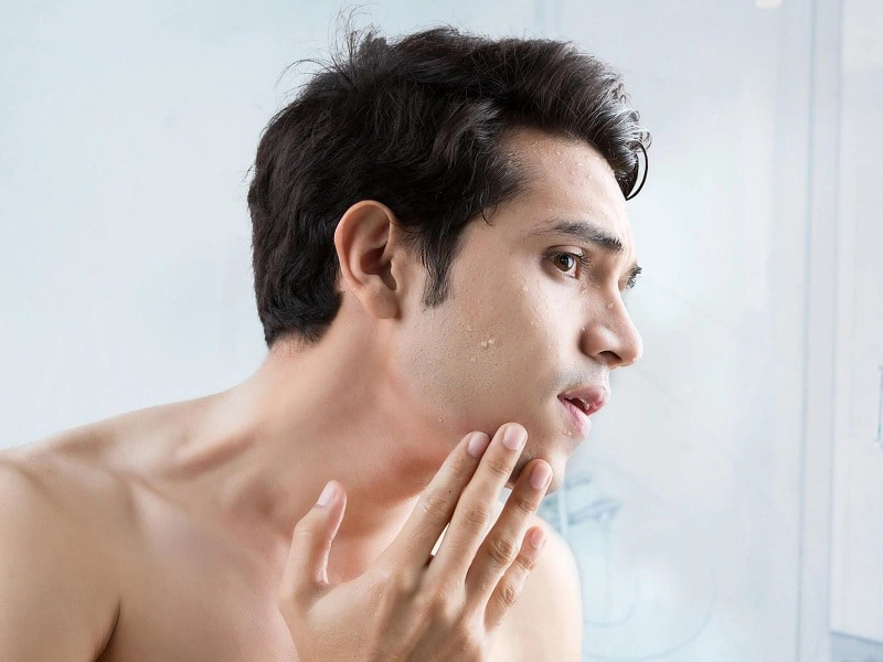 Nhổ râu bằng nhíp có nên không? Có ảnh hưởng gì không? 2