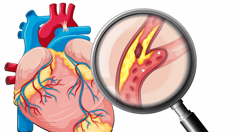 Các bệnh về tim mạch và cách phòng chống2
