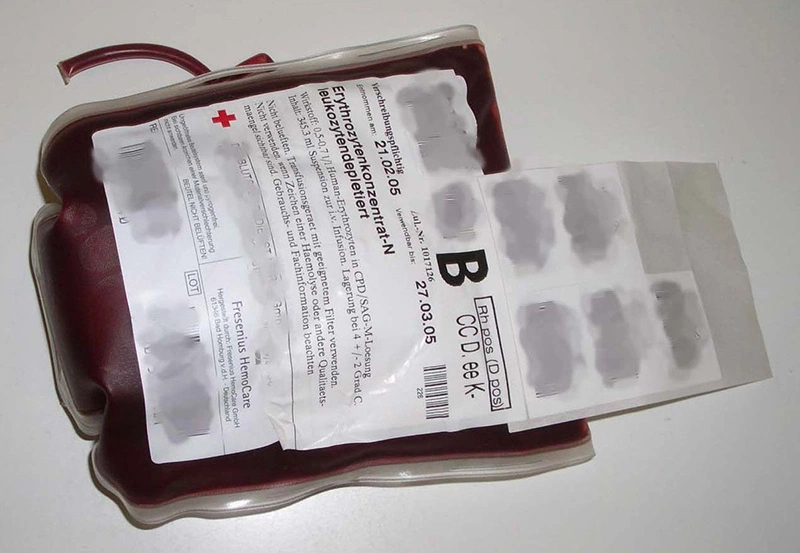 Nhóm máu B được coi là nhóm máu hiếm thứ 2 trên thế giới