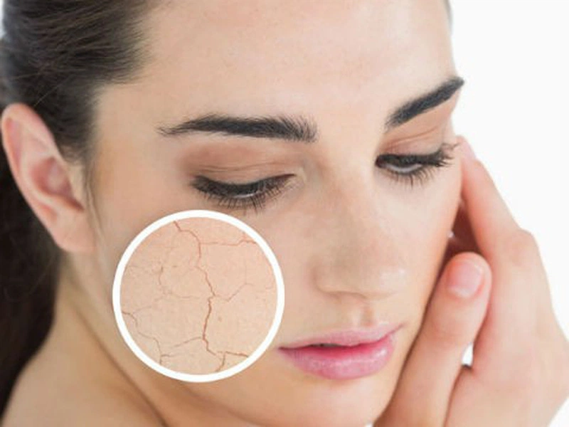 Những bệnh thường gặp nhất khi thời tiết quá lạnh 3