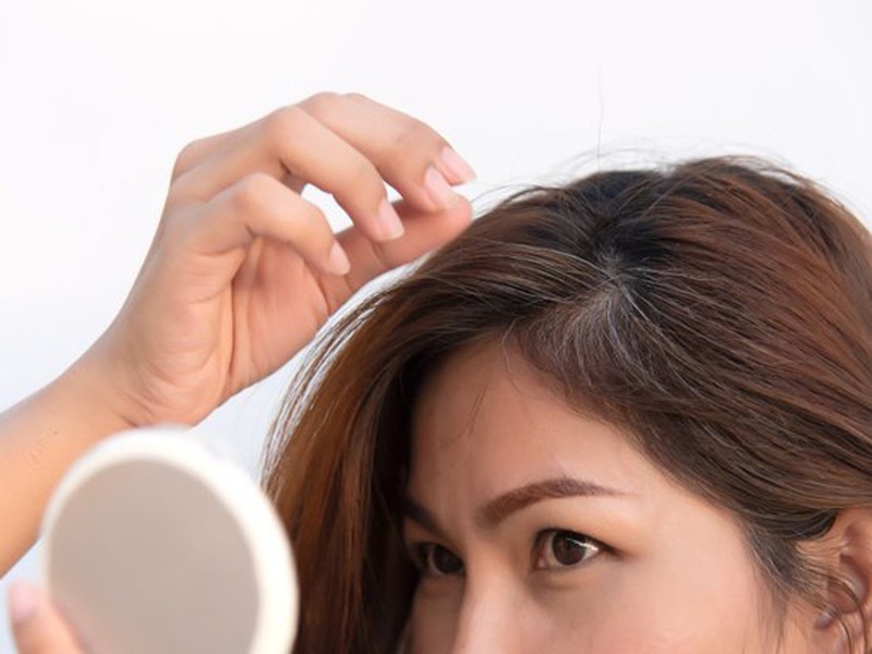 Những cách cải thiện tóc bạc sớm ở giới trẻ 1