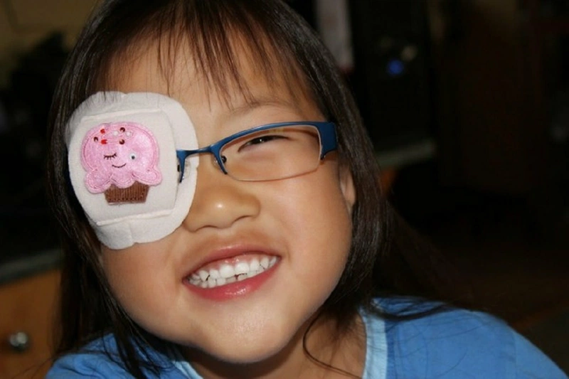 Những cách chữa trị bệnh lác mắt ở trẻ 2