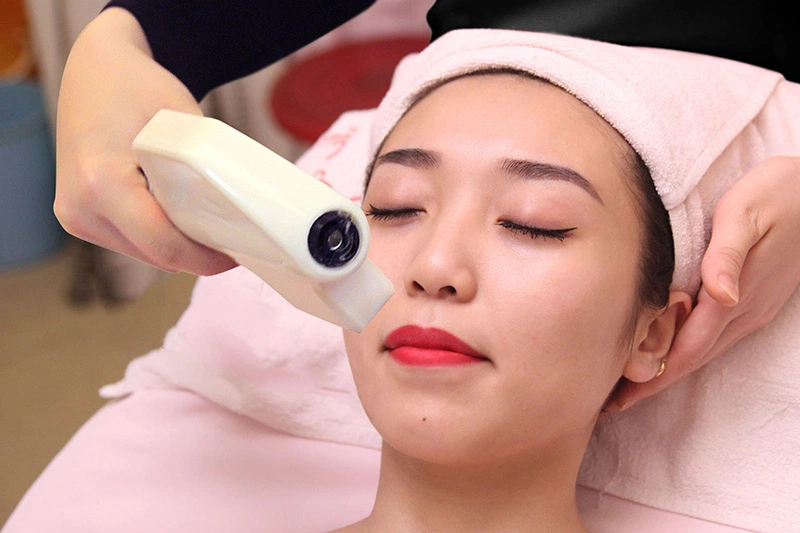 Những cách làm mờ ria mép bị thâm tại nhà hiệu quả nhất