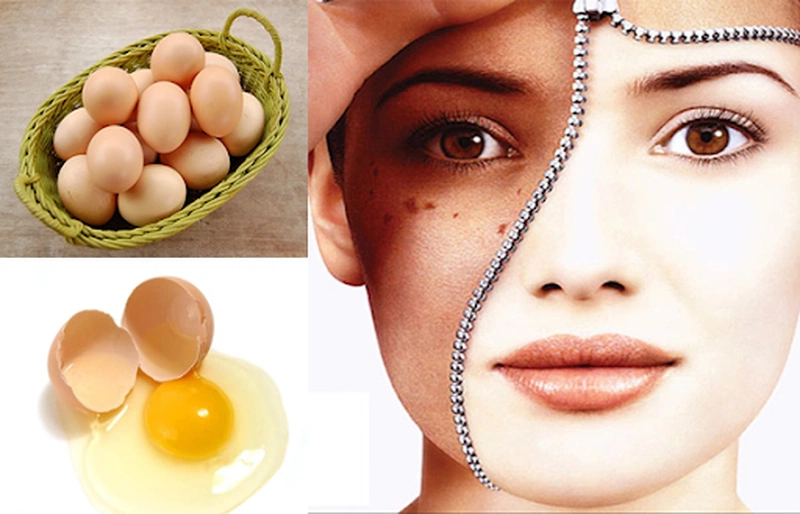 Những cách trị nám tàn nhang tại nhà bằng vitamin E tại nhà hiệu quả nhất 2