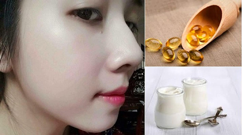 Những cách trị nám tàn nhang tại nhà bằng vitamin E tại nhà hiệu quả nhất 4