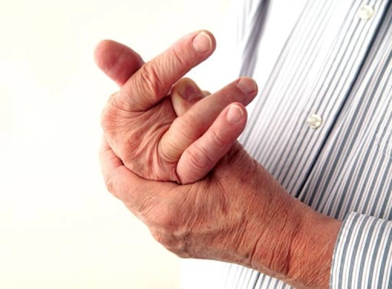 Những dấu hiệu bệnh gút ở tay bạn nên biết 1