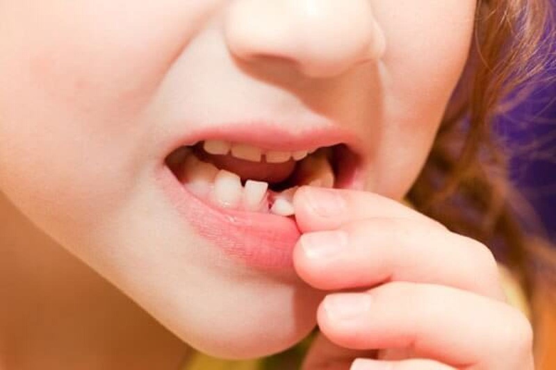 Chảy máu nướu răng là tình trạng rất hay gặp khi trẻ mọc răng